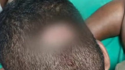 Policeman hit on the head with helmet in Thiruvananthapuram