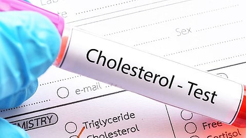 Cholestrol test