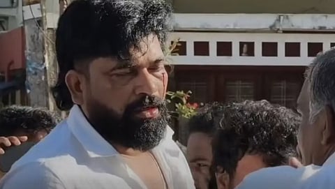 Kerala Congress Clash