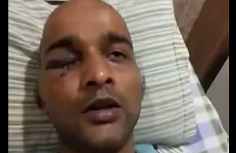 ബീഫ് കഴിക്കുന്ന നിന്നെ കൊല്ലും എന്ന് പറഞ്ഞ് ആക്രമിച്ചു;കേസ് അട്ടിമറിക്കാന്‍ ശ്രമിക്കുന്നു, ഐഐടിയിലെ അക്രമം തുറന്നുപറഞ്ഞ് സൂരജ് 
