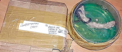 അപ്രതീക്ഷിതമായി ഒരു 'കോംപ്ലിമെന്ററി ​ഗിഫ്റ്റ്' ; തുറന്നു നോക്കിയപ്പോൾ ഞെട്ടിപ്പോയി 