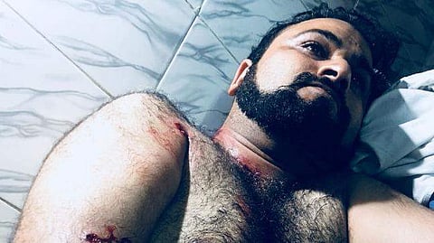കഫീല്‍ ഖാന്റെ സഹോദരന് വെടിയേറ്റു; അവര്‍ തങ്ങളെ എപ്പോഴും കൊല്ലാന്‍ ശ്രമിക്കുന്നുവെന്ന് കഫീല്‍ഖാന്‍