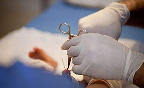 ചേലാകര്‍മത്തിനിടെ കുഞ്ഞിന്റെ മുക്കാല്‍ഭാഗം ജനനേന്ദ്രിയം മുറിഞ്ഞുപോയി; ഡോക്റ്റര്‍ക്കെതിരേ പരാതിയുമായി മാതാപിതാക്കള്‍