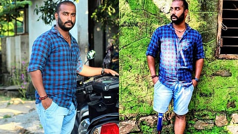 ഒറ്റക്കാലുള്ള നിങ്ങളെ കല്യാണം കഴിച്ചാല്‍ നമ്മളെങ്ങനെ ജീവിക്കും?സ്‌നേഹിച്ച പെണ്ണ് വഞ്ചിച്ചു; നല്ല നട്ടെല്ലുള്ള ആണ്‍പിള്ളേര്‍ക്ക് ഒരു കാല്‍ തന്നെ ധാരാളം...; ചെറുപ്പക്കാരന്റെ അതിജീവനകഥ