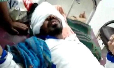 പ്രണയം നിരസിച്ചു; യുവാവിന്റെ മുഖത്ത് ആസിഡ് ഒഴിച്ച് യുവതി