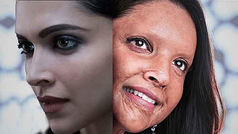 മേക്കപ്പണിഞ്ഞ് പുറത്തിറങ്ങിയപ്പോൾ ആരും എന്നെ തിരിച്ചറിഞ്ഞില്ല, ആദ്യമായി പ്രോസ്തെറ്റിക് ചിത്രത്തിൽ അഭിനയിച്ചതിനെക്കുറിച്ച് ദീപിക 