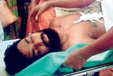 എസ്എഫ്‌ഐ പ്രവര്‍ത്തകരുടെ കുത്തേറ്റ വിദ്യാര്‍ത്ഥി ആശുപത്രി വിട്ടു; രണ്ടുമാസത്തെ പൂര്‍ണവിശ്രമം വേണമെന്ന് ഡോക്ടര്‍മാര്‍