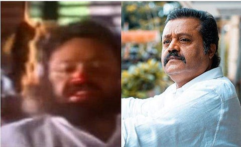 'സുരേഷ് ​ഗോപിക്ക് തിന്നാൻ കൊടുത്തത് ജീവനുള്ള എലിയെ'; യുവതുർക്കിയിലെ ആ രം​ഗത്തെക്കുറിച്ച് പ്രൊഡക്ഷൻ കൺട്രോളർ