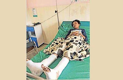 റോഡില്‍ നിന്ന് ഇറങ്ങി നടന്നില്ല; വിദ്യാര്‍ത്ഥിയെ ഇടിച്ചിട്ട് കാലുകളിലൂടെ കാര്‍ കയറ്റിയിറക്കി, ഗുരുതര പരിക്ക്