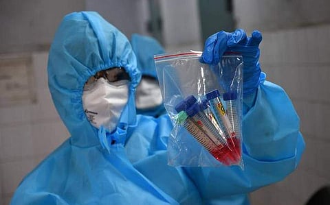 ഒമാനിൽ ഇന്ന് 55 പേർക്ക് കൂടി കോവിഡ് 