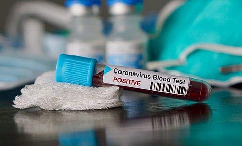 തിരുവനന്തപുരം എ ആര്‍ ക്യാമ്പിലെ പൊലീസുകാരന് കോവിഡ് ; ഉറവിടം വ്യക്തമല്ല