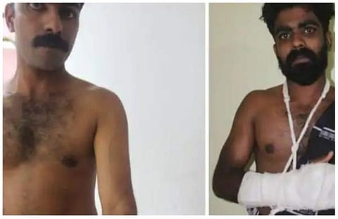 പൊലീസ് മര്‍ദനത്തില്‍ പരിക്കേറ്റ സഹോദരങ്ങള്‍