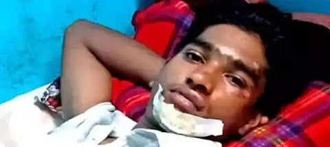 പരിക്കേറ്റ ദേവരാജ്‌