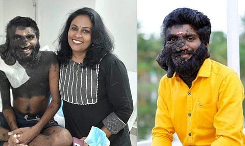 'വേദനയിലും ചിരിയോടെ എന്നെ സ്വീകരിച്ചു, സ്വപ്നങ്ങളും പ്രതീക്ഷകളും ഏറെയുണ്ടായിരുന്ന രാജകുമാരൻ'; പ്രഭുലാലിന്റെ മരണത്തിൽ സീമ ജി നായർ