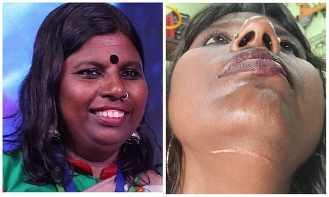 അഡ്വ. കുക്കു ദേവകി/ഫെയ്‌സ്ബുക്ക്