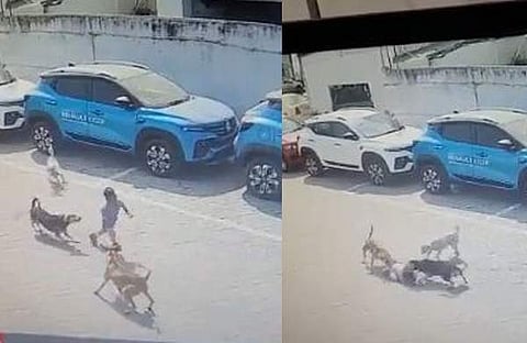 നാലു വയസ്സുകാരനെ നായ്ക്കള്‍ ആക്രമിക്കുന്നു/ വിഡിയോ ദൃശ്യം