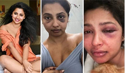 നടി അനിഖ വിക്രമന്‍