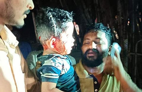 പുലി ആക്രമണത്തില്‍ പരിക്കേറ്റ മൂന്നുവയസുകാരന്‍/ ട്വിറ്റര്‍