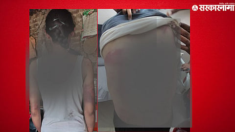 Victim woman lawyer in Ambajogai, Beed, was brutally assaulted by a group led by the village sarpanch