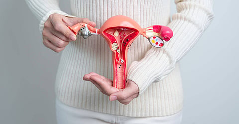 Davao City logs 88 cervical cancer deaths in 2023