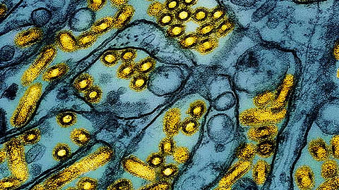 This colorized electron microscope image released by the National Institute of Allergy and Infectious Diseases on March 26, 2024, shows avian influenza A H5N1 virus particles (yellow), grown in Madin-Darby Canine Kidney (MDCK) epithelial cells (blue). 