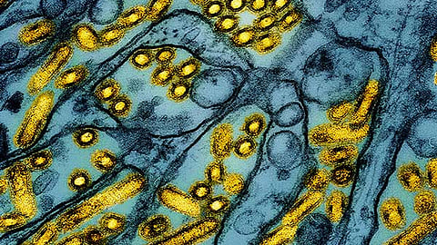 California declared an emergency over bird flu.