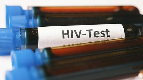 HIV surge in PH: DOH urges national health emergency 