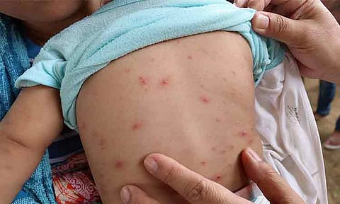 Inquiry into skin, dermatology clinics operations pushed