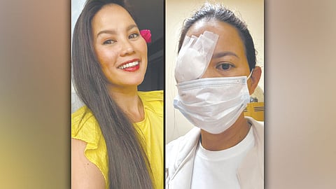 Del Rosario undergoes minor
eye surgery after infected stye