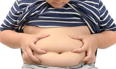 Groups urge Congress to curb rising childhood overweight and obesity