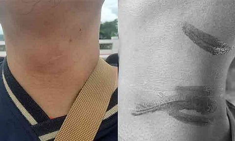 Viral social media post showed a motorcycle rider suffering neck lacerations after being struck by a kite string while traveling on the highway.