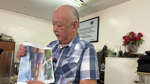 NBI: Rape suspect died of blunt trauma