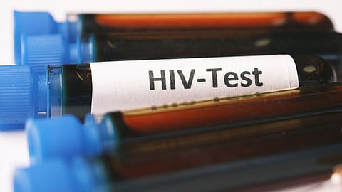 HIV test