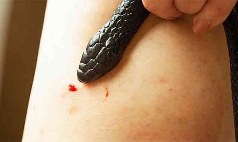 SPMC warns of rising snakebite cases