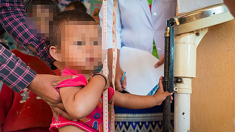 Funding shortfalls hamper Cebu City’s fight vs child malnutrition