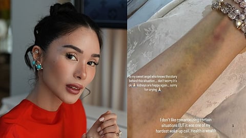 Heart Evangelista discharged 
from hospital