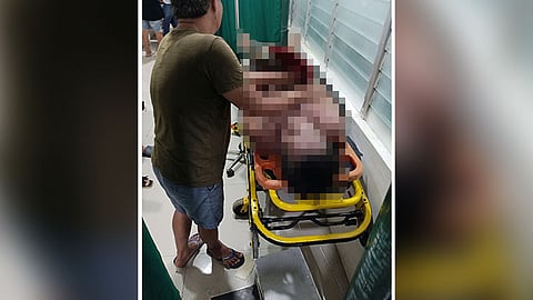 Nanginhas-patay human maigo sa kilat 
