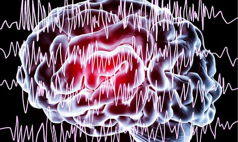 High epilepsy cases at SPMC
