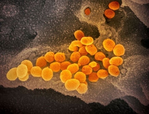 Boy, 9, positive for Delta variant