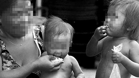 LGUs urged to step up malnutrition intervention