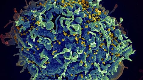 10 minors among new HIV cases in Cebu; Advocates push for wider education