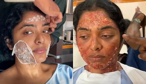 'ഓരോ ദിവസവും നാല് മണിക്കൂറിലധികം എടുത്താണ് ആ മേക്കപ്പ് ഒരുക്കിയത്'; ‘തീയേറ്റർ’ പ്രോസ്തറ്റിക് മേക്കപ്പ് വീഡിയോയുമായി സേതു