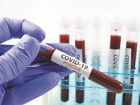 ID Card Must For COVID-19 tests in Bihar, after several gaps found in testing data