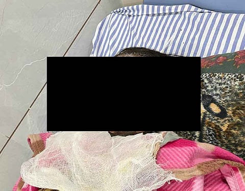राजस्थान: रेप कर दलित विवाहिता को केमिकल डालकर जलाया, इलाज के दौरान मौत