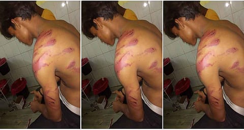 उत्तर प्रदेश: दलित युवक को निर्ममता से पीटा, पुलिस आने पर बची जान!