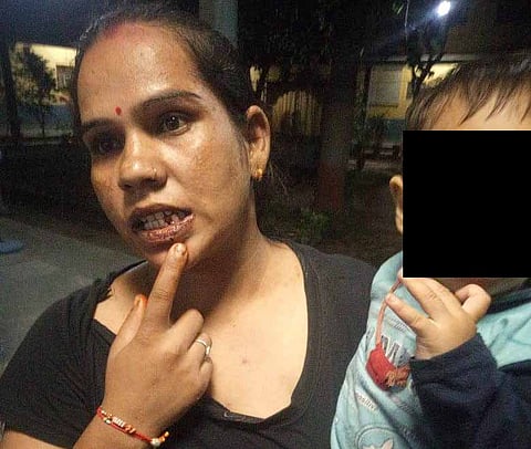 राजस्थान में बच्चा पड़ोसी के कमरे के सामने गया तो मां की पिटाई. पीड़ित महिला