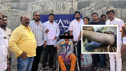 महराष्ट्र: पुलिस चौकी में आदिवासी महिला के साथ बर्बरता, पिटाई से हाथ-पैर काले पड़े
