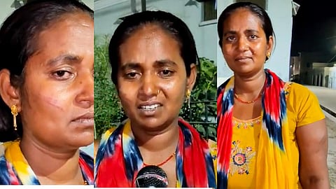 
पीड़ित महिला उर्मिला और उन्हें आये चोट के निशान
