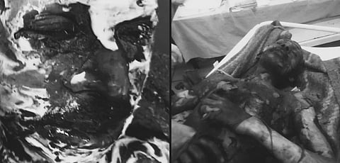  दलित समाज से ताल्लुक रखने वाले 55 वर्षीय चौकीदार जैसलाल सरोज पर ग्राम प्रधान के पुत्र ने कथित तौर पर केरोसीन डालकर आग लगा दी, जिससे वे 80 प्रतिशत से अधिक झुलस गए। 