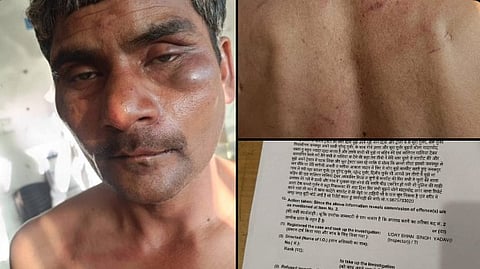 पीड़ित ने थाना सिविल लाइन में प्रथम सूचना रिपोर्ट दर्ज कराई 